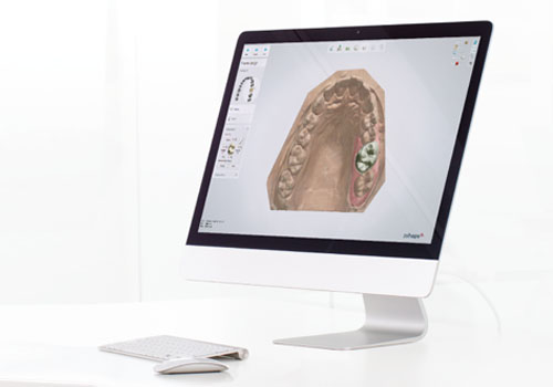 Dental System