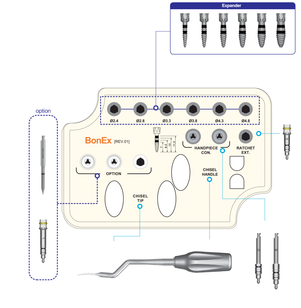 کیت ریج اسپلیت BonEx